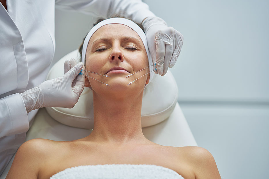 Lifting facial: ¿Cómo es el proceso paso a paso?