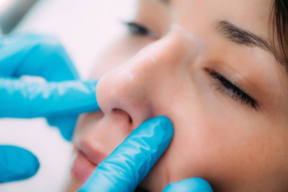 preparación para una cirugía de nariz en CDMX