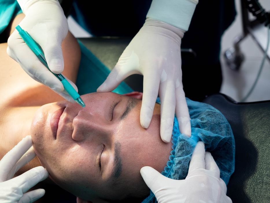 ¿Cómo elegir un cirujano para lifting facial en CDMX?