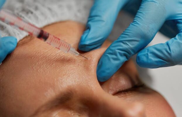 ¿Qué son los fillers y para qué zonas del rostro se recomiendan?