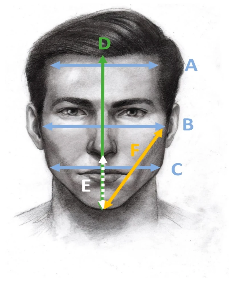 planeación quirúrgica rinoplastia masculina análisis morfológico de perfil