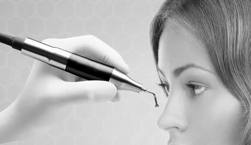 Rinoplastia ultrasónica en CDMX: qué es y cómo funciona