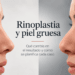 rinplastia y piel gruesa